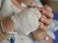 Dziecko z wenflonem w dłoni. Obrazek ilustruje, co to za choroba, jaką jest błonica, i jej leczenie.