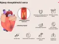 Objawy niewydolności serca: ból w klatce, omdlenia, zmęczenie, obrzęki nóg, kaszel, duszności, nudności. Zablokowana tętnica wieńcowa i uszkodzony mięsień sercowy.