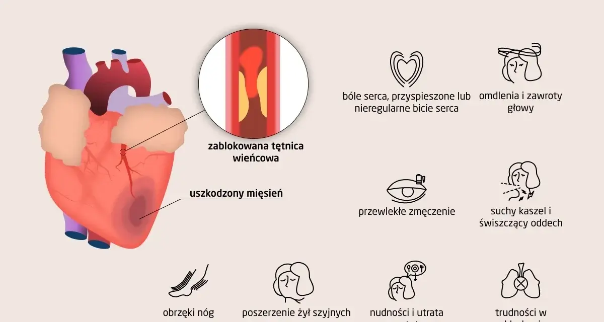 Objawy niewydolności serca: ból w klatce, omdlenia, zmęczenie, obrzęki nóg, kaszel, duszności, nudności. Zablokowana tętnica wieńcowa i uszkodzony mięsień sercowy.
