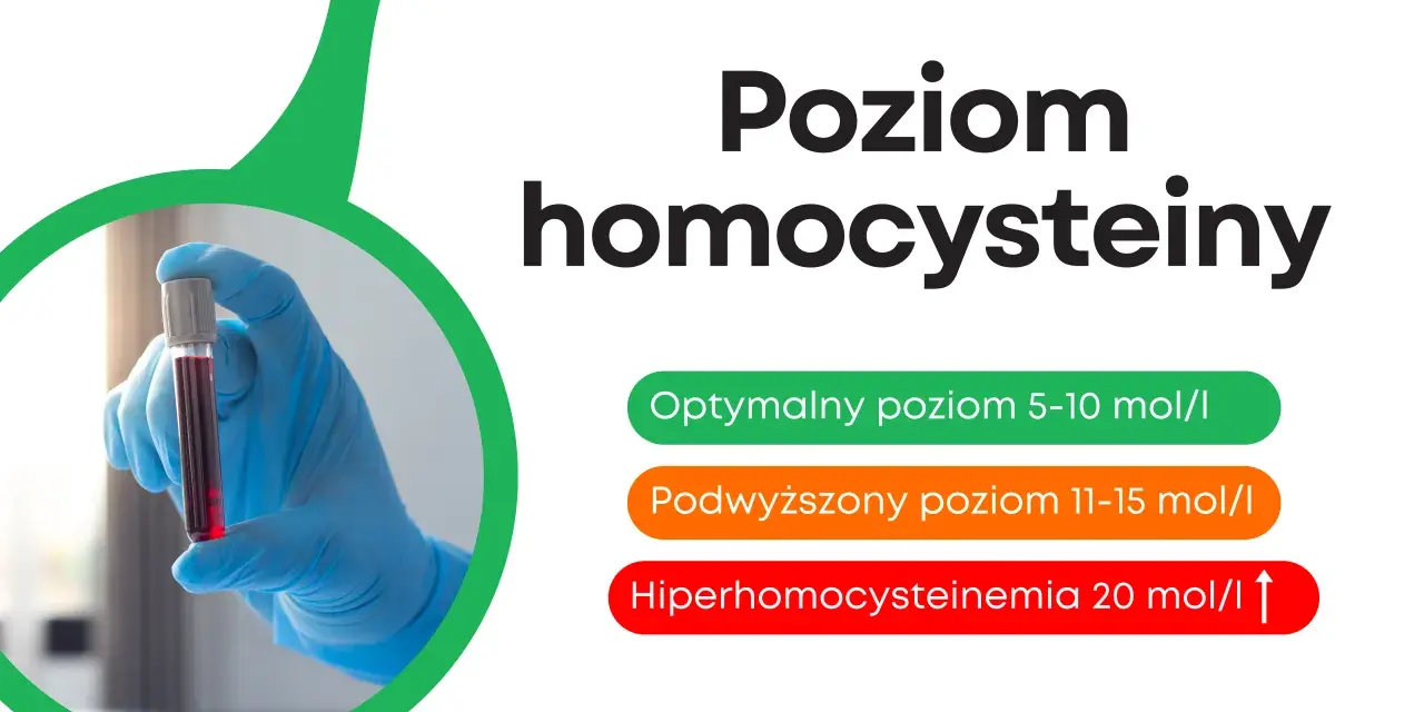 Poziom homocysteiny: optymalny 5-10, podwyższony 11-15, hiperhomocysteinemia >20. Ręka w rękawiczce trzyma probówkę z krwią.