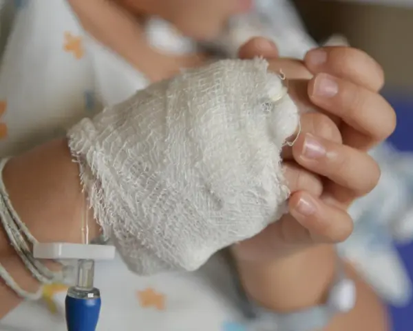 Dziecko z wenflonem w dłoni. Obrazek ilustruje, co to za choroba, jaką jest błonica, i jej leczenie.