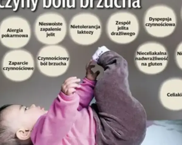 Dziecko z podkurczonymi nóżkami, nad którym widnieją kółka z przyczynami bólu brzucha u dziecka, np. nietolerancja laktozy.