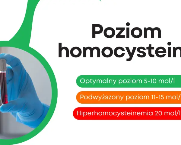 Poziom homocysteiny: optymalny 5-10, podwyższony 11-15, hiperhomocysteinemia >20. Ręka w rękawiczce trzyma probówkę z krwią.