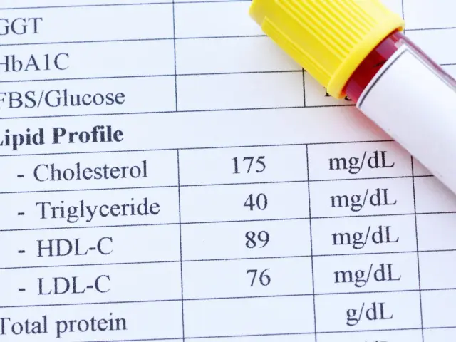 Wynik lipidogramu: cholesterol 175, trójglicerydy 40, HDL-C 89, LDL-C 76 mg/dL. Badanie lipidogram co to za badania?
