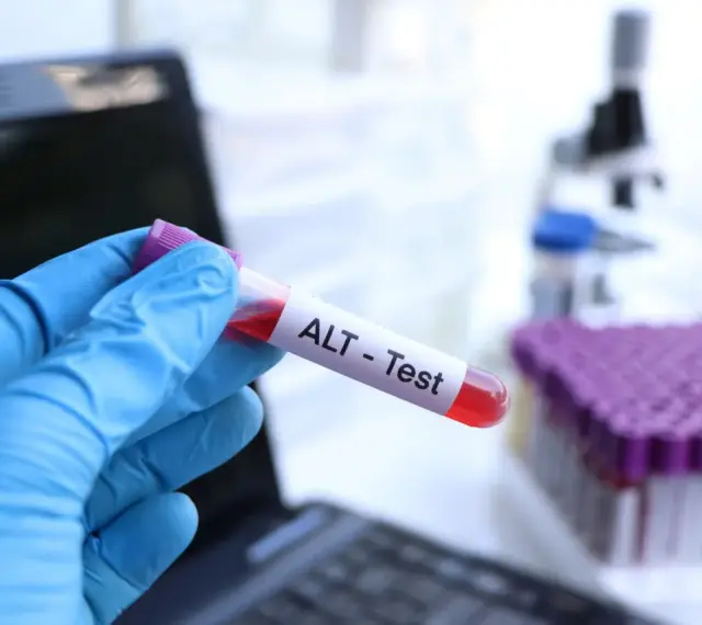 Ręka w niebieskiej rękawiczce trzyma probówkę z krwią oznaczoną "ALT - Test". W tle widać mikroskop i stojak z probówkami. To badanie ALT.