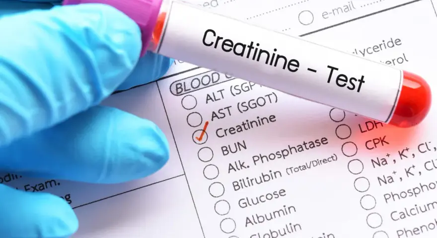 Rękawiczka w niebieskiej rękawiczce trzyma probówkę z napisem "Creatinine - Test". Obok zaznaczono "Kreatynina co to za badanie".