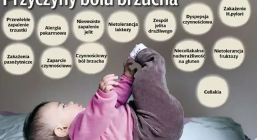 Dziecko z podkurczonymi nóżkami, nad którym widnieją kółka z przyczynami bólu brzucha u dziecka, np. nietolerancja laktozy.