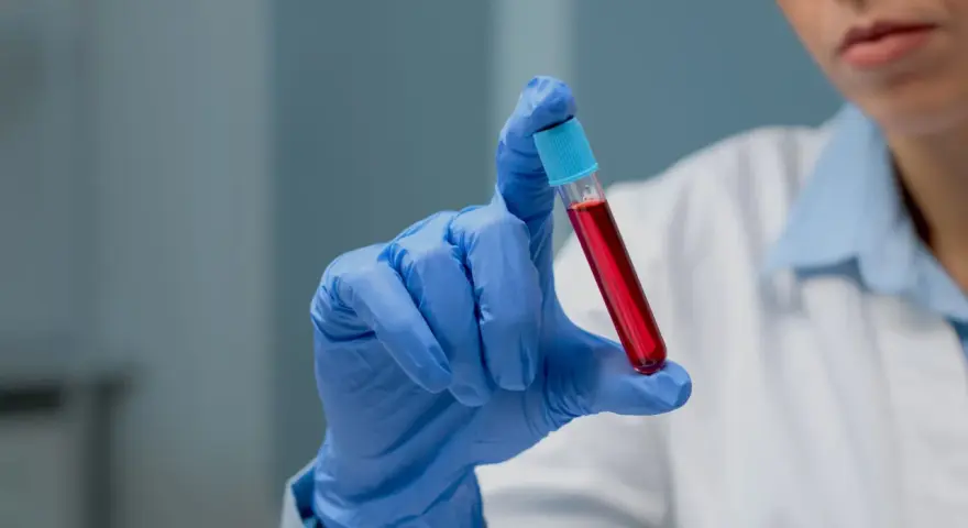 Ręka w niebieskiej rękawiczce trzyma probówkę z czerwoną cieczą. To może być próbka do badań, np. PDW co to jest, czyli wskaźnik anizocytozy płytek krwi.