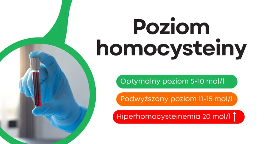 Poziom homocysteiny: optymalny 5-10, podwyższony 11-15, hiperhomocysteinemia >20. Ręka w rękawiczce trzyma probówkę z krwią.