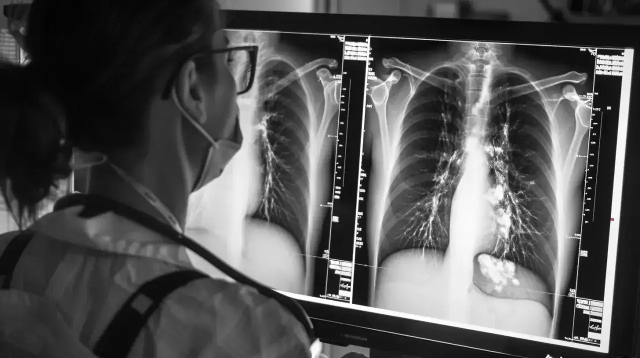 Lekarka analizuje RTG płuc, szukając oznak problemów, takich jak woda w płucach.