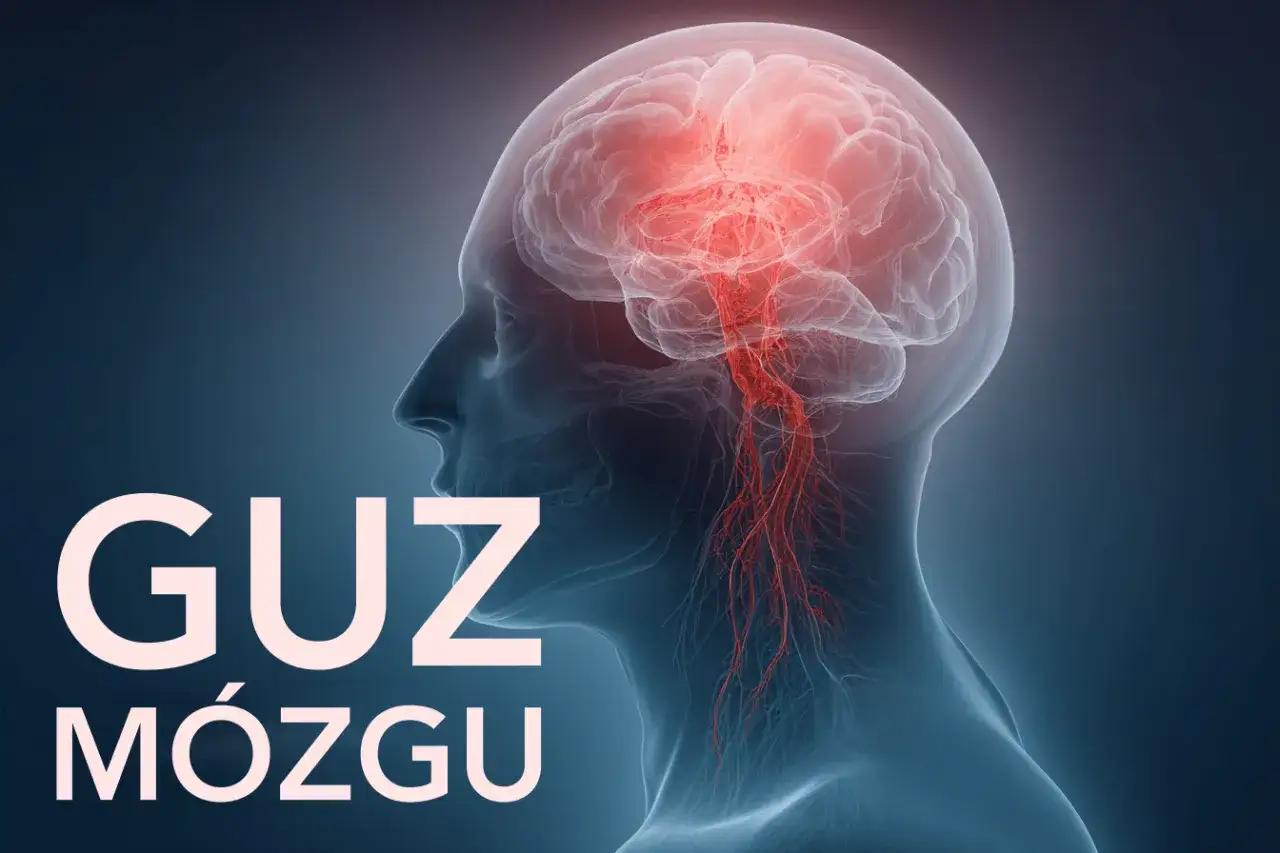 Przezroczysty profil głowy z widocznym mózgiem, gdzie czerwone naczynia krwionośne sugerują objawy guza mózgu.