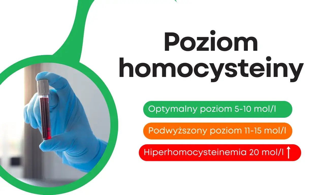 Poziom homocysteiny: optymalny 5-10, podwyższony 11-15, hiperhomocysteinemia >20. Ręka w rękawiczce trzyma probówkę z krwią.