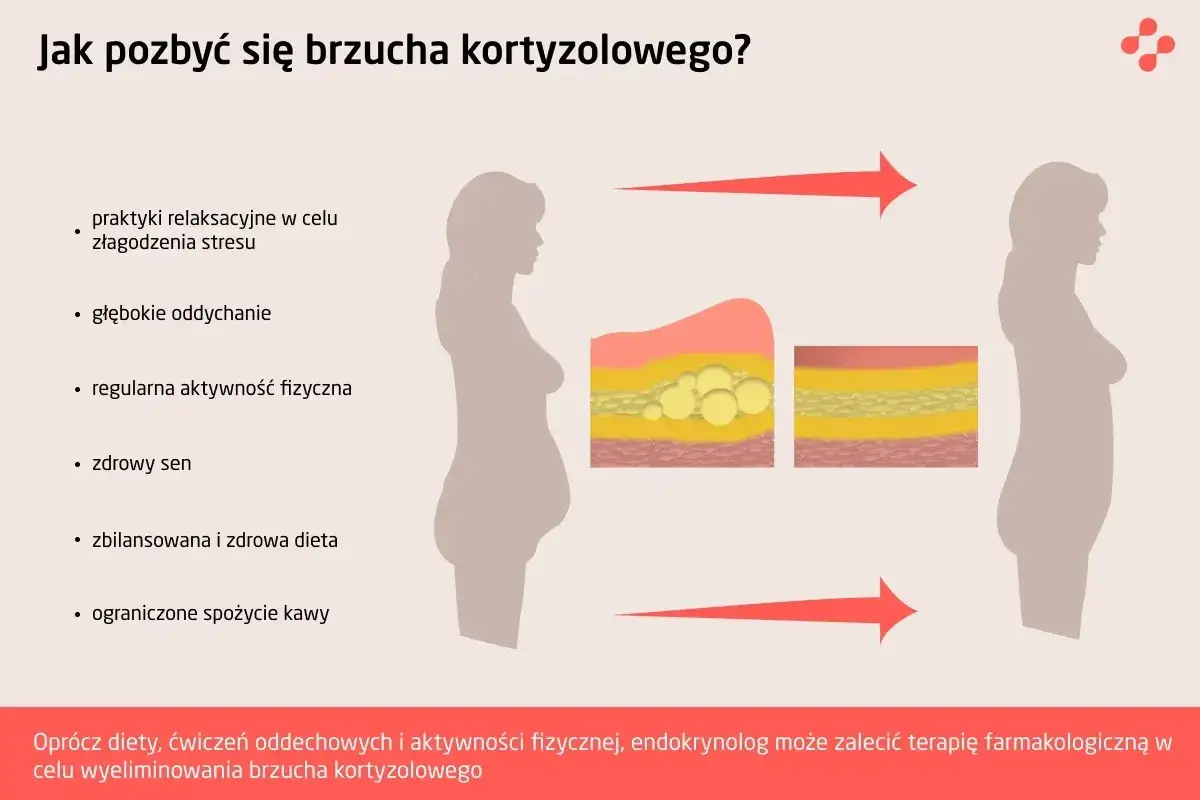 Grafika pokazuje, jak pozbyć się brzucha kortyzolowego. Przedstawia sylwetkę kobiety z nadwagą, przekrój skóry z nagromadzoną tkanką tłuszczową, a następnie sylwetkę tej samej kobiety po redukcji.