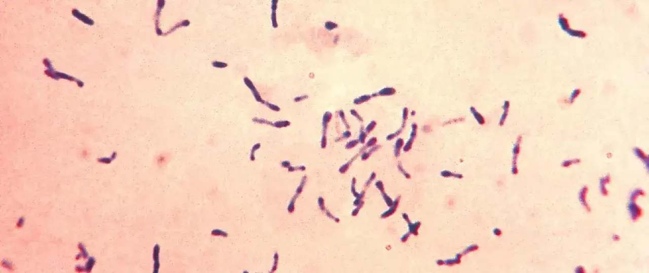 Mikroskopowy obraz bakterii Corynebacterium diphtheriae, wywołujących błonicę. To poważna choroba zakaźna.