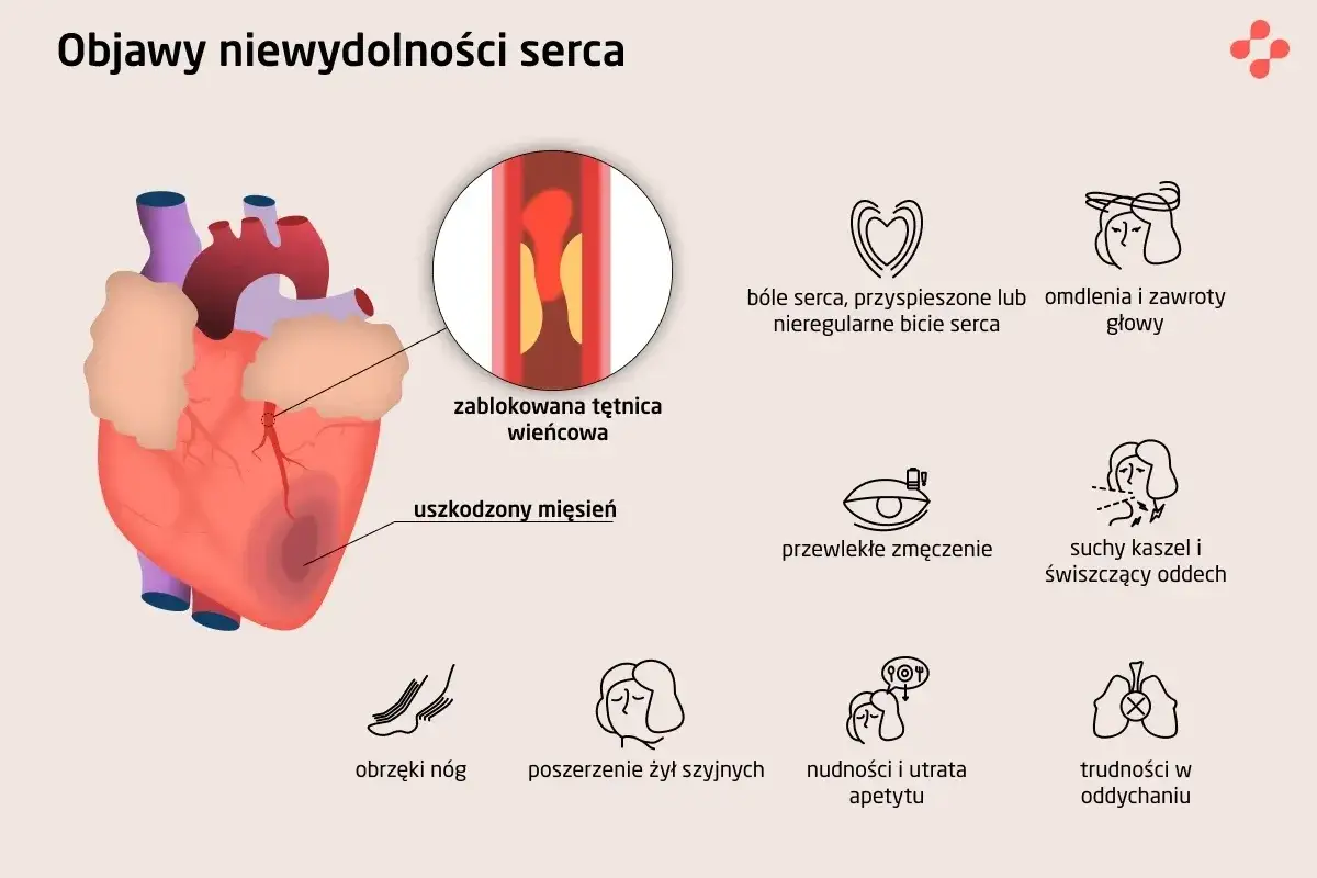 Objawy niewydolności serca: ból w klatce, omdlenia, zmęczenie, obrzęki nóg, kaszel, duszności, nudności. Zablokowana tętnica wieńcowa i uszkodzony mięsień sercowy.