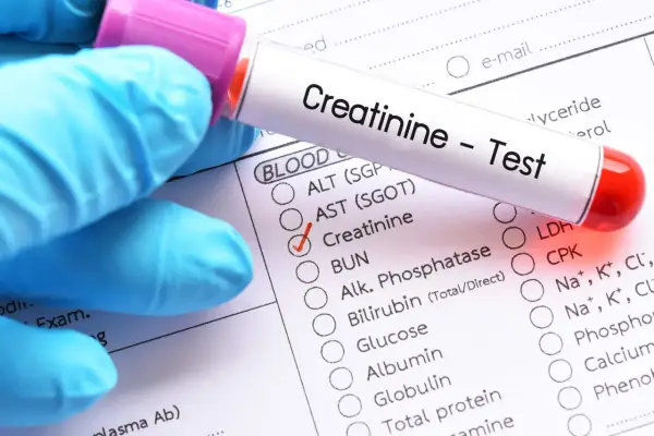 Rękawiczka w niebieskiej rękawiczce trzyma probówkę z napisem "Creatinine - Test". Obok zaznaczono "Kreatynina co to za badanie".