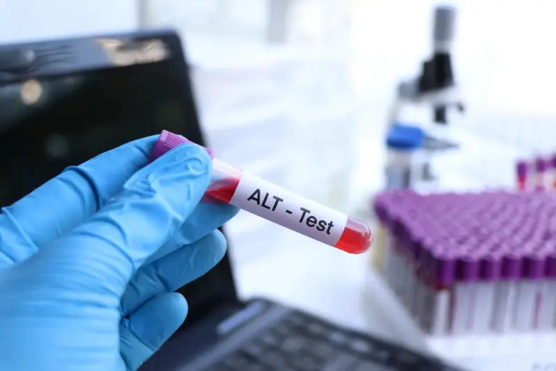 Ręka w niebieskiej rękawiczce trzyma probówkę z krwią oznaczoną "ALT - Test". W tle widać mikroskop i stojak z probówkami. To badanie ALT.